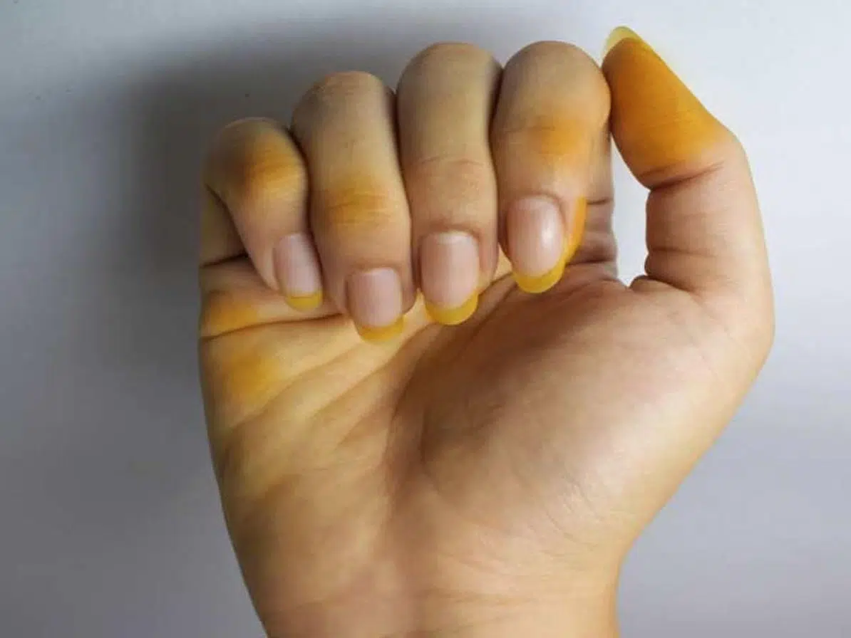 close up of woman's hand that has been covered in turmeric